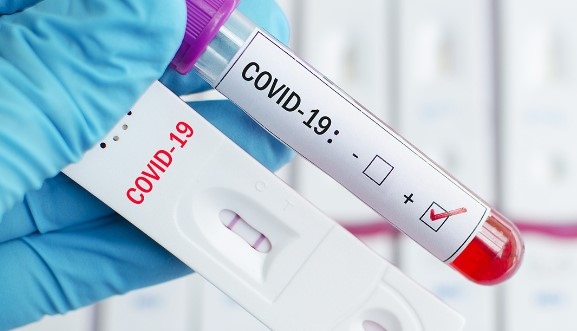 1150 са новите случаи на коронавирус у нас при направени